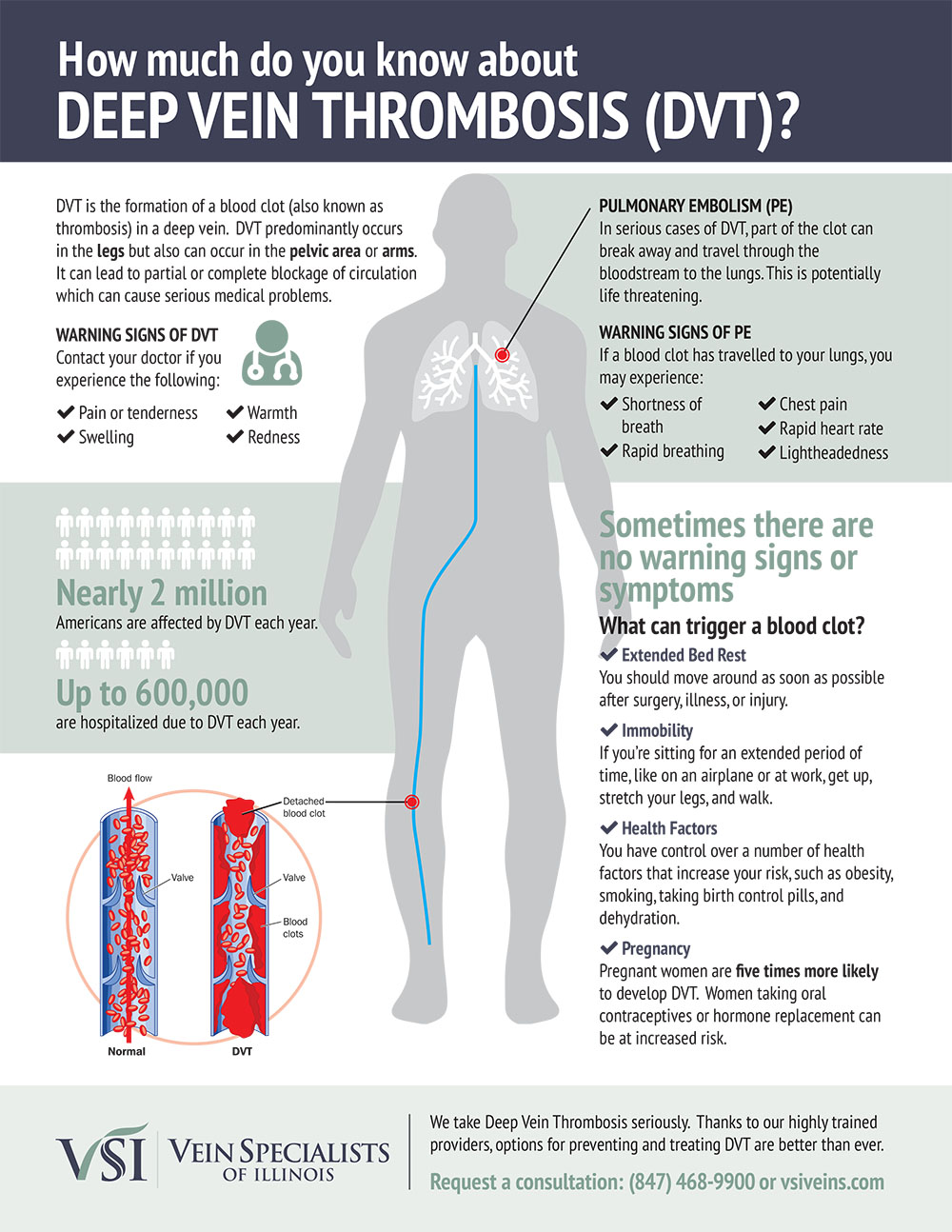 Leg Vein Chart